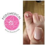 Podologia pediatryczna