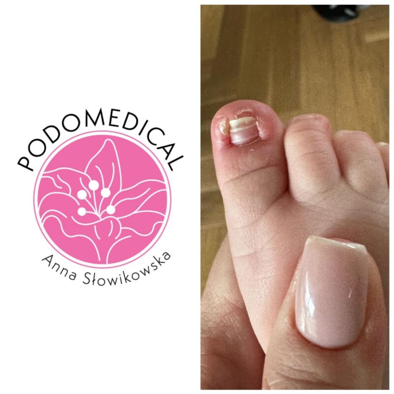 Podologia pediatryczna